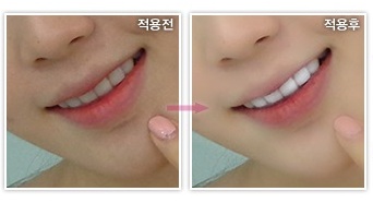 Beauty Effect - 3